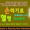 백혈병의 원인과 치료 방법은 있을까 이미지