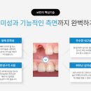 ID치과기공소 이미지