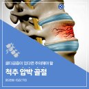 송파 척추수술병원, 골다공증이 있다면 주의해야 하는 척추 압박골절 이미지