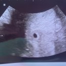 미나벨라여성의원 | 산전검사] 임신 사전건강관리 지원사업 부부 후기/ 미나벨라여성의원, 아이오라여성의원 산전검사 후기