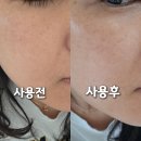 스킨아이디어 | 멜로스킨 미백앰플 후기｜미백, 흔적완화앰플 1주 사용 변화