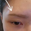 뽑기플러스 | 내돈내산, 샤프심 눈썹산 뿌리뽑기, 눈썹레이저제모 4회차 후기, 아포지플러스제모