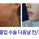 서울제일성형외과의원 이미지