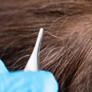 "흰머리 미워 마세요…천연 항암 효과와 관련 있다" 이미지