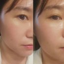 [강서구 명지] 문제성피부 관리받고 온 러브리뷰티 후기