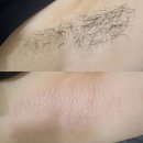 라퓨어왁싱 이미지