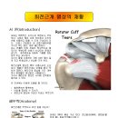 Rotator cuff tear(번역) 이미지