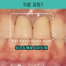 유성치과기공소 이미지