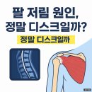팔 저림, 정말 목디스크일까? 이미지