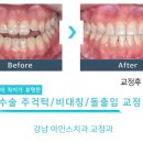 아인스치과교정과치과의원 이미지