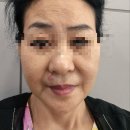 뷰앤플의원 이미지
