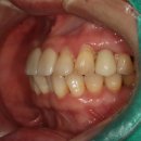 여치과기공소 이미지