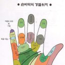 뜸 이미지
