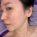 경산 중방동피부관리 빅토리아오브모아뷰티 피부관리 후기