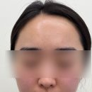 중리시장 | 대전 중리시장 피부관리샵 미온담 솔직후기