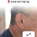 시그니아 독일보청기 이미지