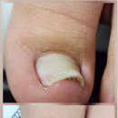 홀리네일