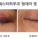 멍하루 이미지