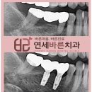 연세바른치과 이미지