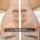 송은미스킨케어