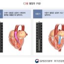 혈압 안 높아도 &#39;이 증상&#39; 있으면 고혈압보다 위험 이미지