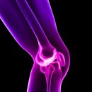 서울제일보조기 이미지