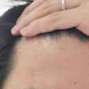 엠이케어 | 모발 성장기에 집중한 탈모 관리, 메타웰 리치엠 핵심 성분 완벽 분석 후기!