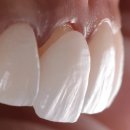 강남삼성치과기공소 이미지