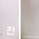 밸런스 스킨케어