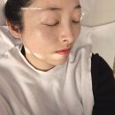 멜라 뷰티 | 대전 기미제거 관리후기 멜라리티 프리진뷰티