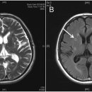 수원-1180 이미지