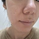 (주)한결상사 | [애터미 주름패치 추천 :: 주름개선 및 미백, 탄력 관리] 아크로패스 라인리프터 V5 마이크로콘 패치