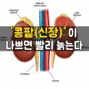 콩팥이 나쁘면 나타나는 증상 이미지