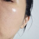 시커먼스 | 청담 피부과 쥬베룩 아이 효과 후기