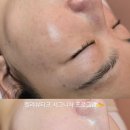 젤라 피부관리