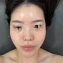 오정로252번길 | 부천 좁쌀여드름 관리 잘하는 곳 스무살에 머물다 부천 오정점