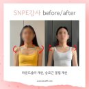 미노원 이미지