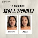 에이치앤제이빌딩 | 석사동피부관리 추천! 제이스킨앤바디에서 받은 춘천피부관리 후기