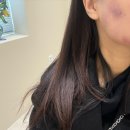 라인하이테크 | 도하담에스테틱 하이테크 v라인윤곽관리 솔직후기