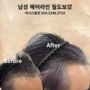 티나스칼프