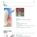 엔도메디칼 이미지