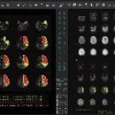 제이엘케이 이미지