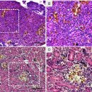 Mycobacterium paragordonae과 2종의 Mycolicibacterium spp감염 비단잉어의 점액세균병 이미지