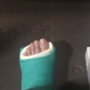 어느날 산책하다 인대가 끊어진 사람이 있다?!