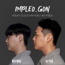 임플레오