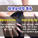 항문 소양증 원인 및 , 똥꼬 가려움 연고 이미지