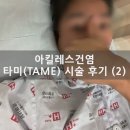 양지병원 아킬레스건염 타미 시술(Tame) 시술 후기 (2) 시술 전 ~ 시술 이후 1달차