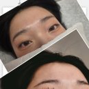 래쉬에프터