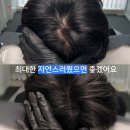 기브유뷰티 | 광주두피문신 정수리 탈모 커버 10년 젊어지는 방법!