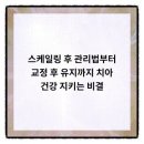 바른이유치과의원 네이버블로그